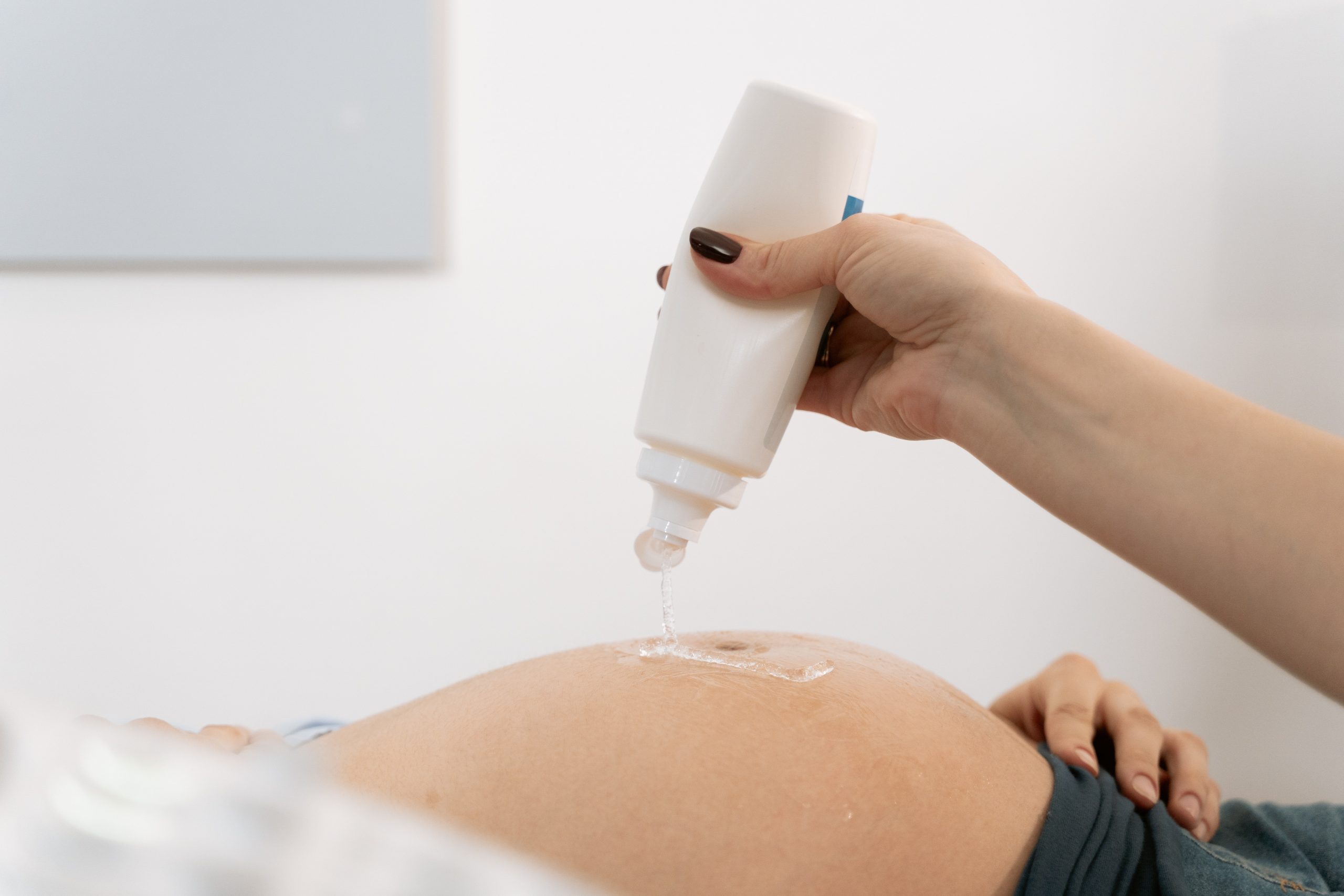 primeras consultas prenatales, doctor poniendo gel en la tripa